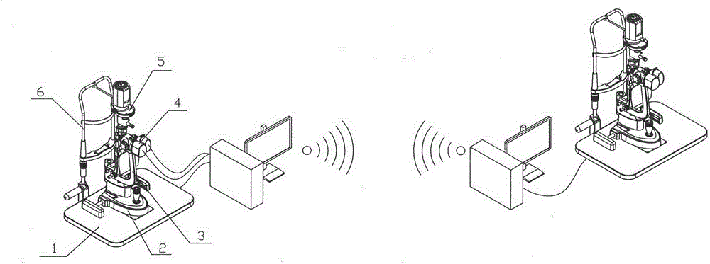 Remote-control slit lamp microscope