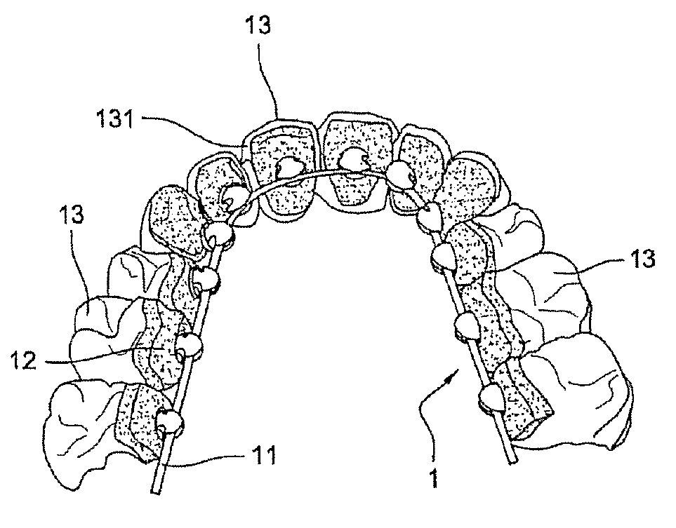 Method for producing a customized orthodontic appliance
