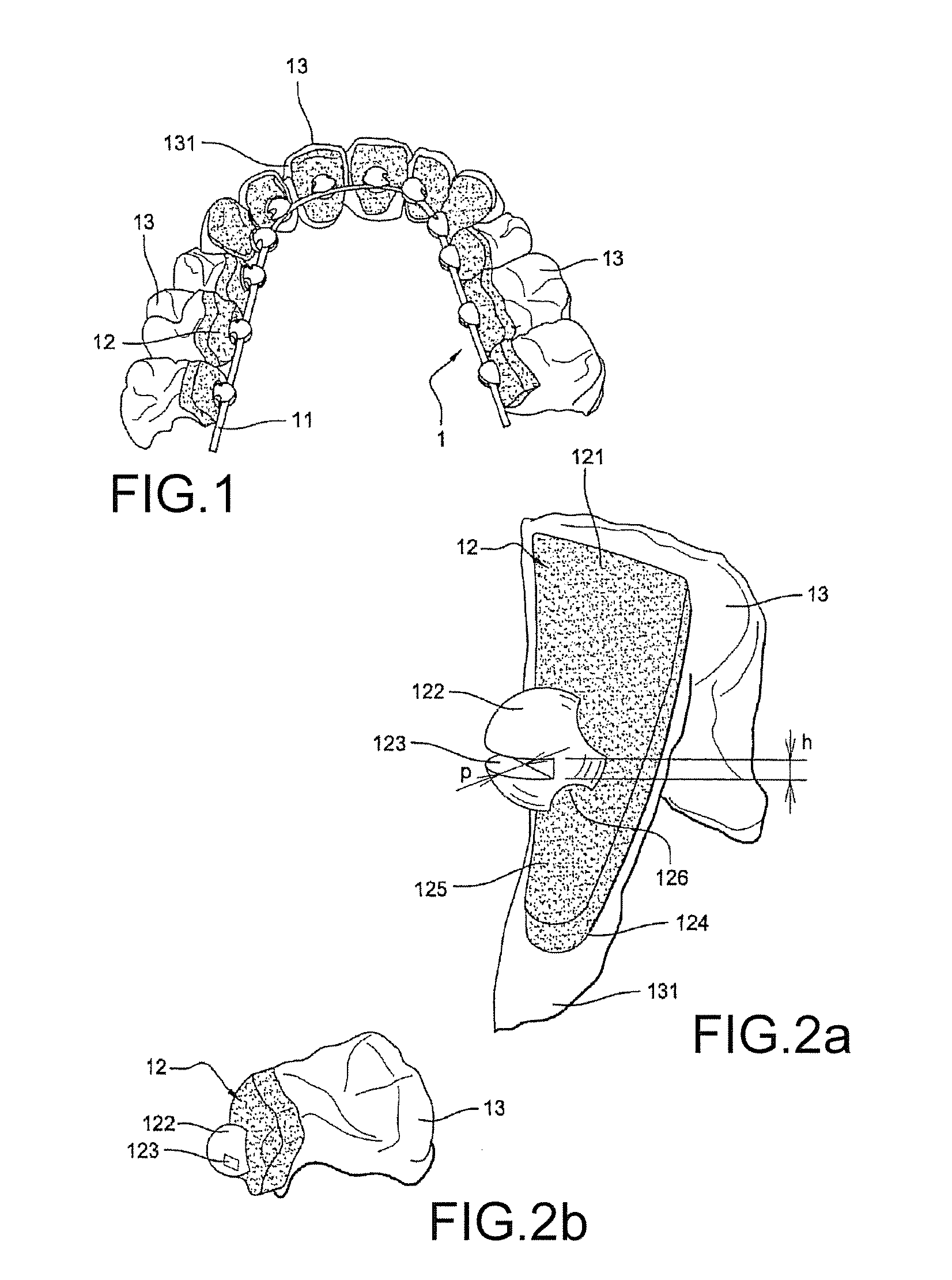 Method for producing a customized orthodontic appliance