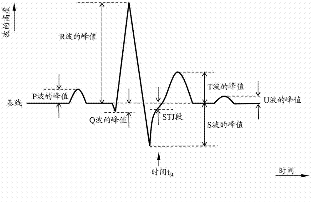 Electrocardiogram analysis report, electrocardiogram analysis apparatus, and electrocardiogram analysis program
