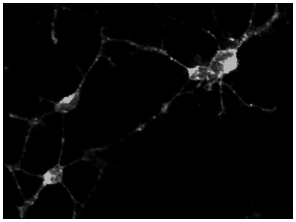 Subpopulation of oligodendrocyte precursor cells and uses thereof