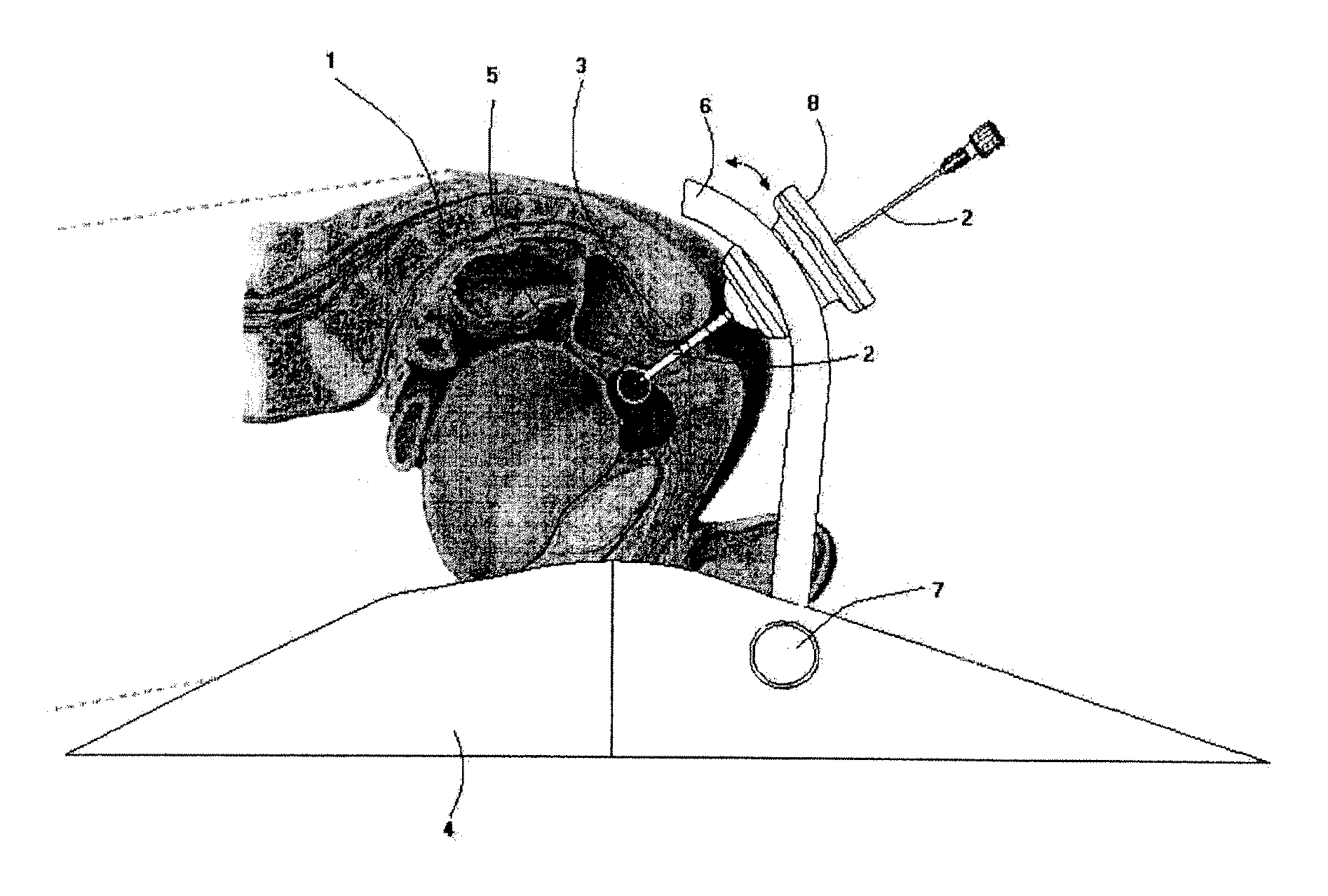 Method and apparatus for MR-guided biopsy