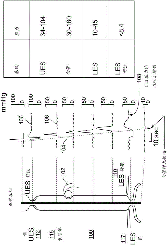 Systems and methods for electrical stimulation of biological systems