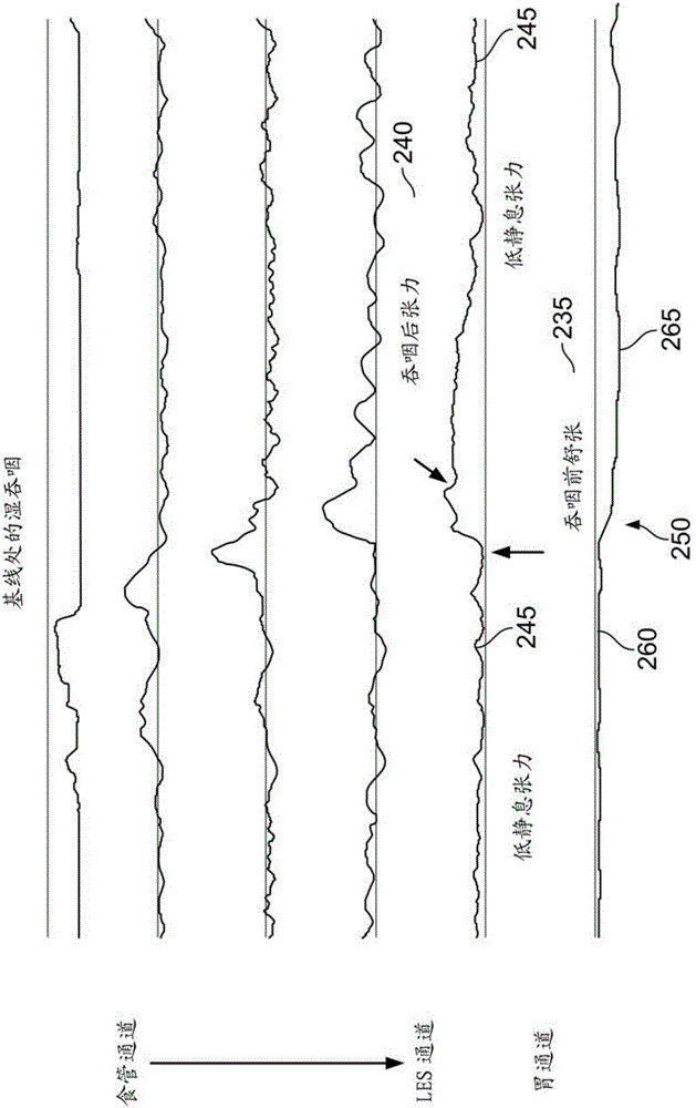 Systems and methods for electrical stimulation of biological systems