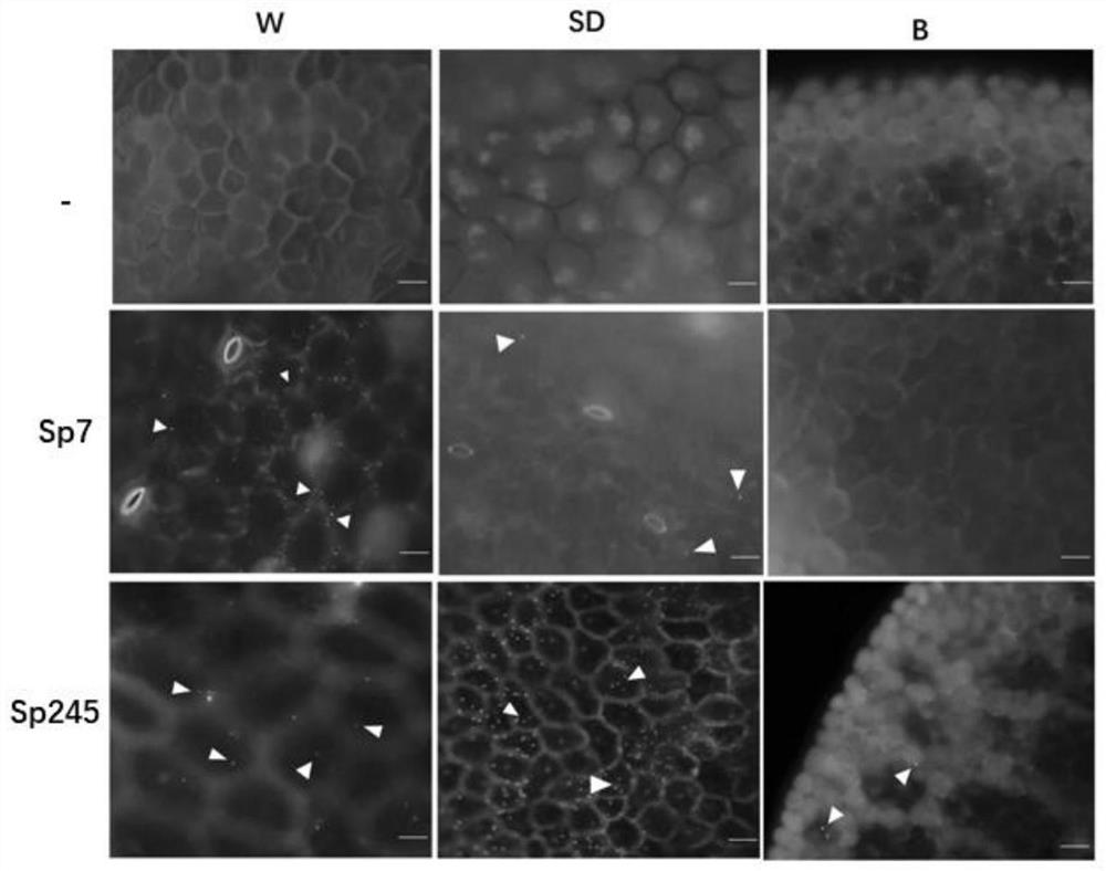 Method for identifying bacterial infection type based on duckweed