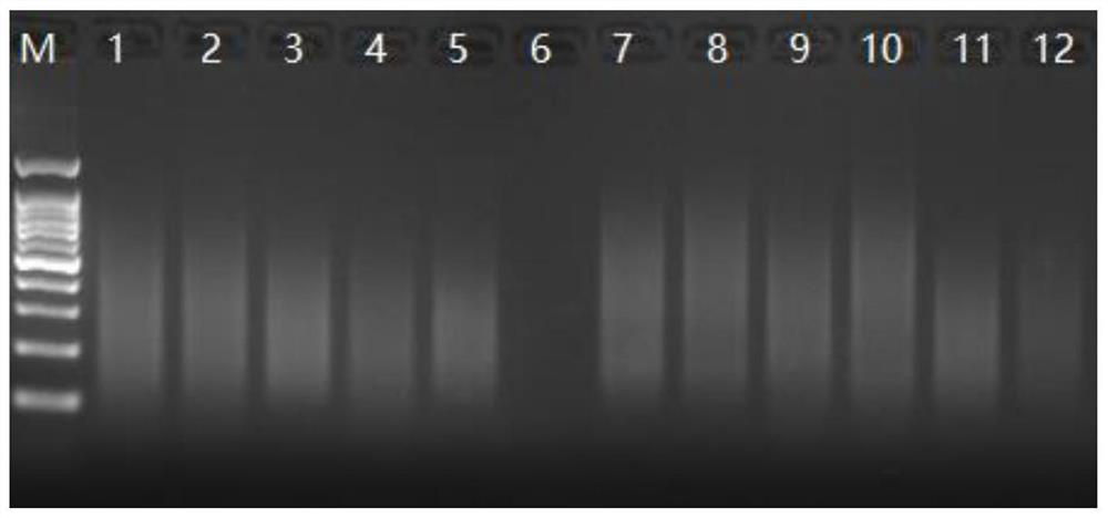 A kind of simultaneous detection kit and method of hpa and hla antigen system