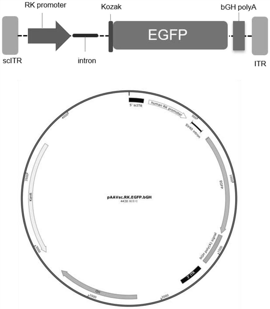 Recombinant adeno-associated virus for efficient tissue-specific expression of RS1 protein and application
