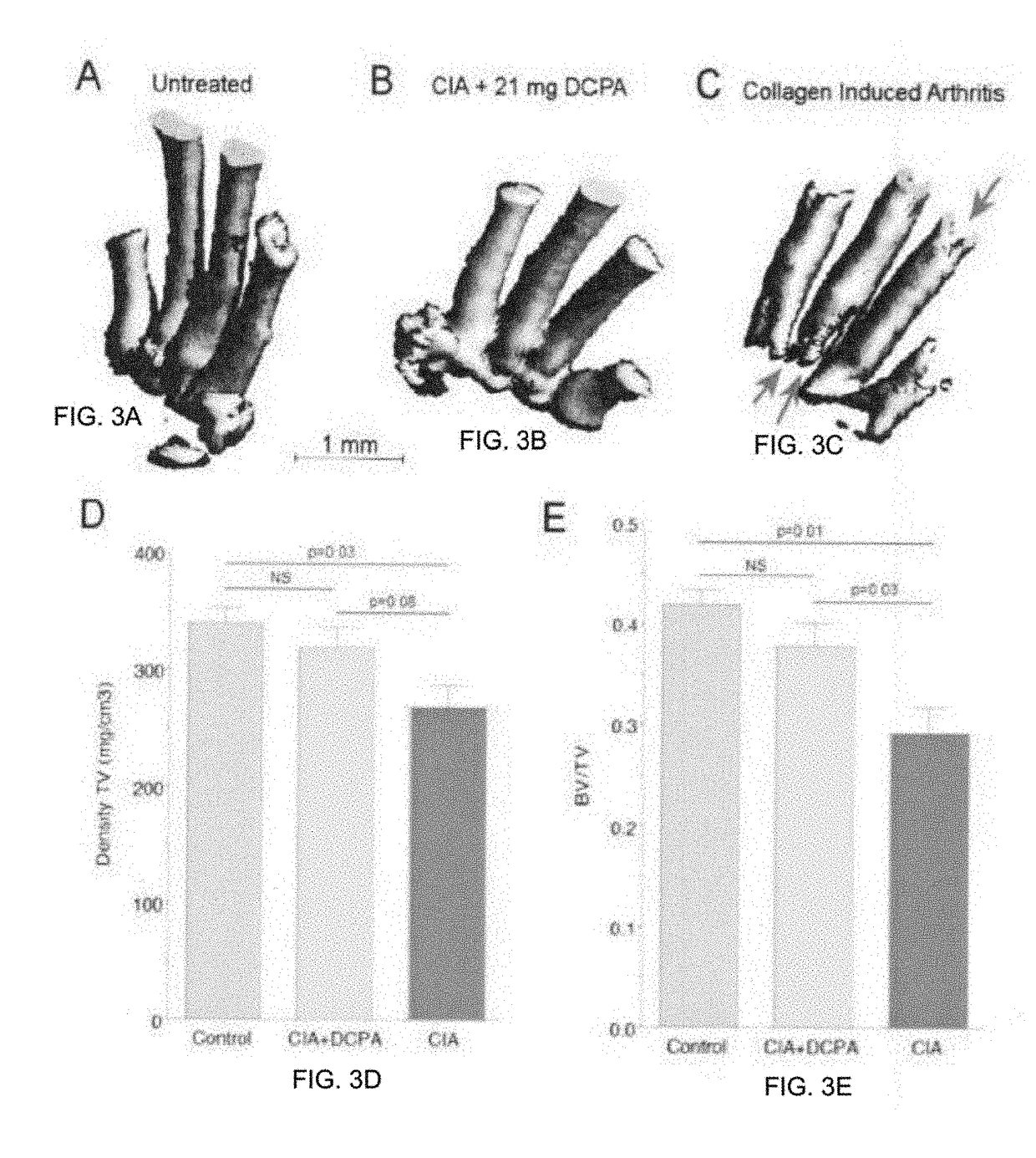 Water Soluble Haloanilide Calcium-Release Calcium Channel Inhibitory Compounds and Methods to Control Bone Erosion and Inflammation Associated with Arthritides