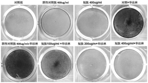 A kind of anti-calcification short peptide and its application