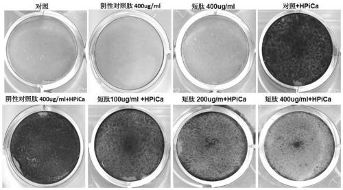 A kind of anti-calcification short peptide and its application