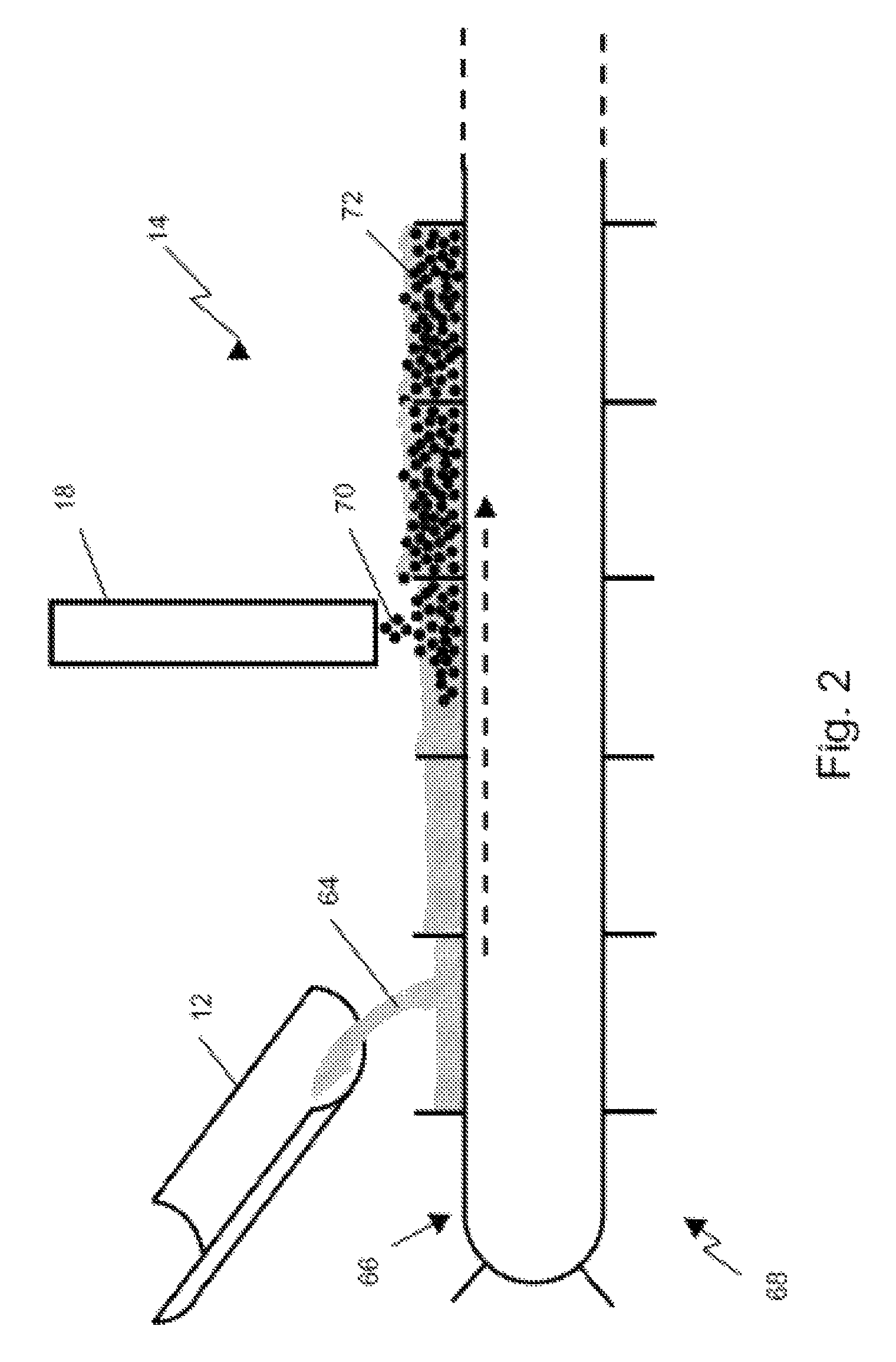 Dry granulation of metallurgical slag