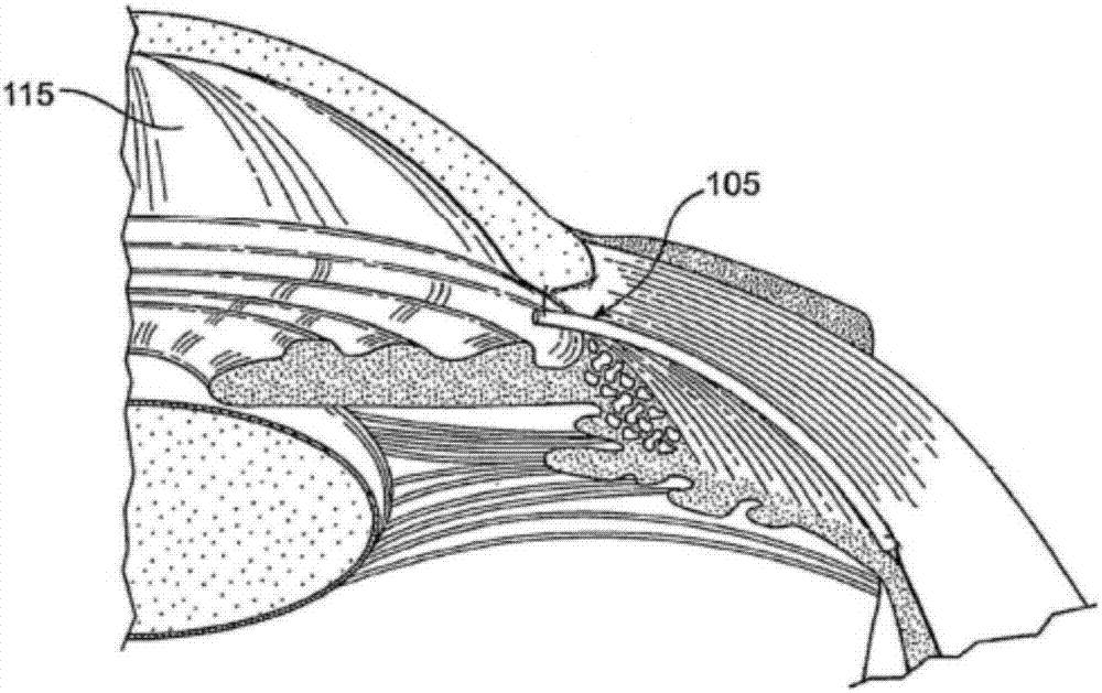 Drainage-type flexible micro support and medical appliance