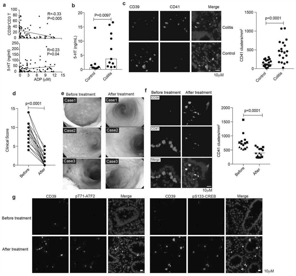 Immune Mechanism and Therapeutic Drugs of Gastrointestinal Diseases