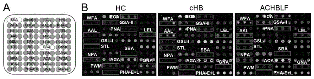 Lectin microarray for detecting carbohydrate chain marker based on protein in saliva, lectin microarray for detecting carbohydrate chain marker jointly based on protein in saliva and serum, kit and applications of lectin microarrays