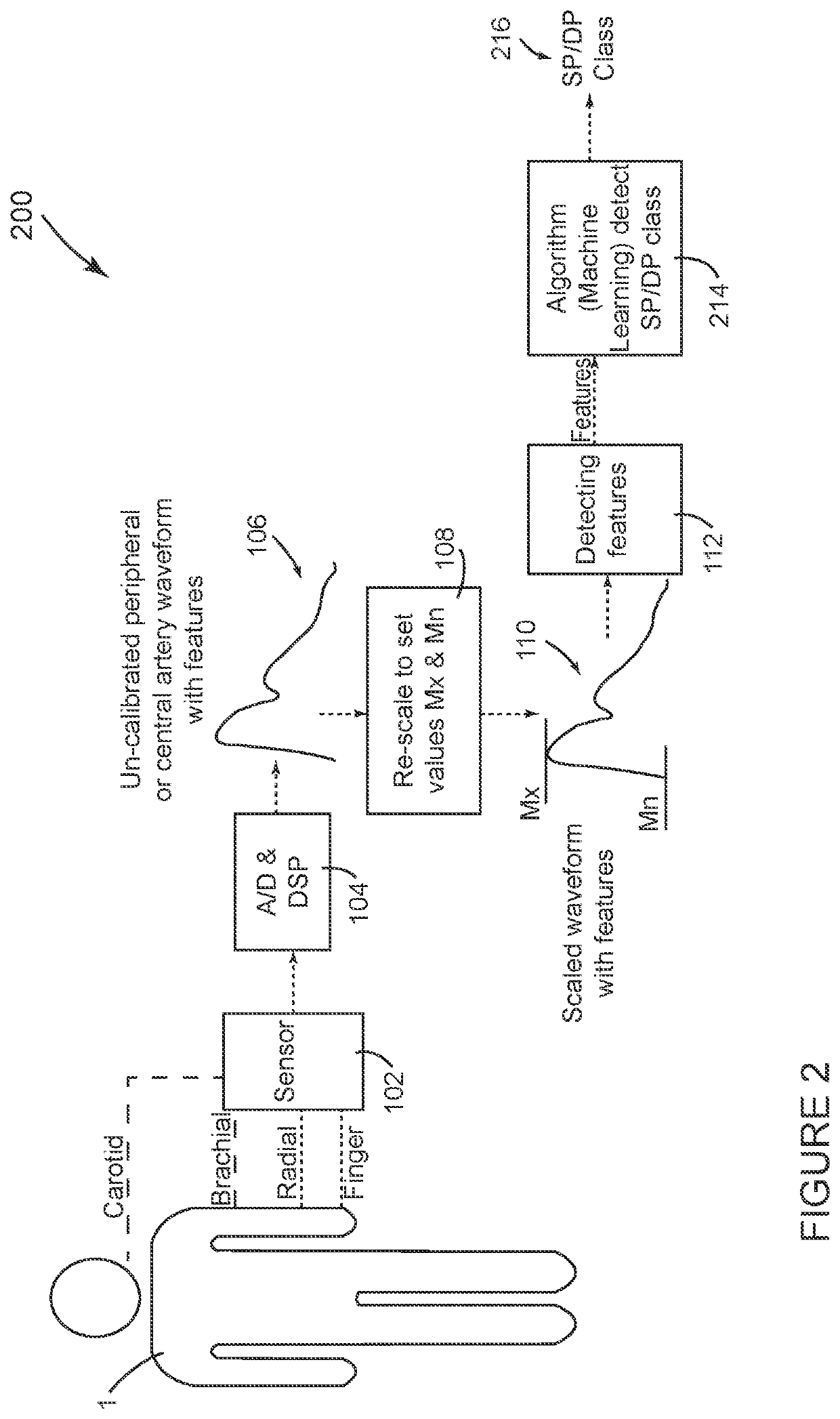 Non-invasive blood pressure measurement