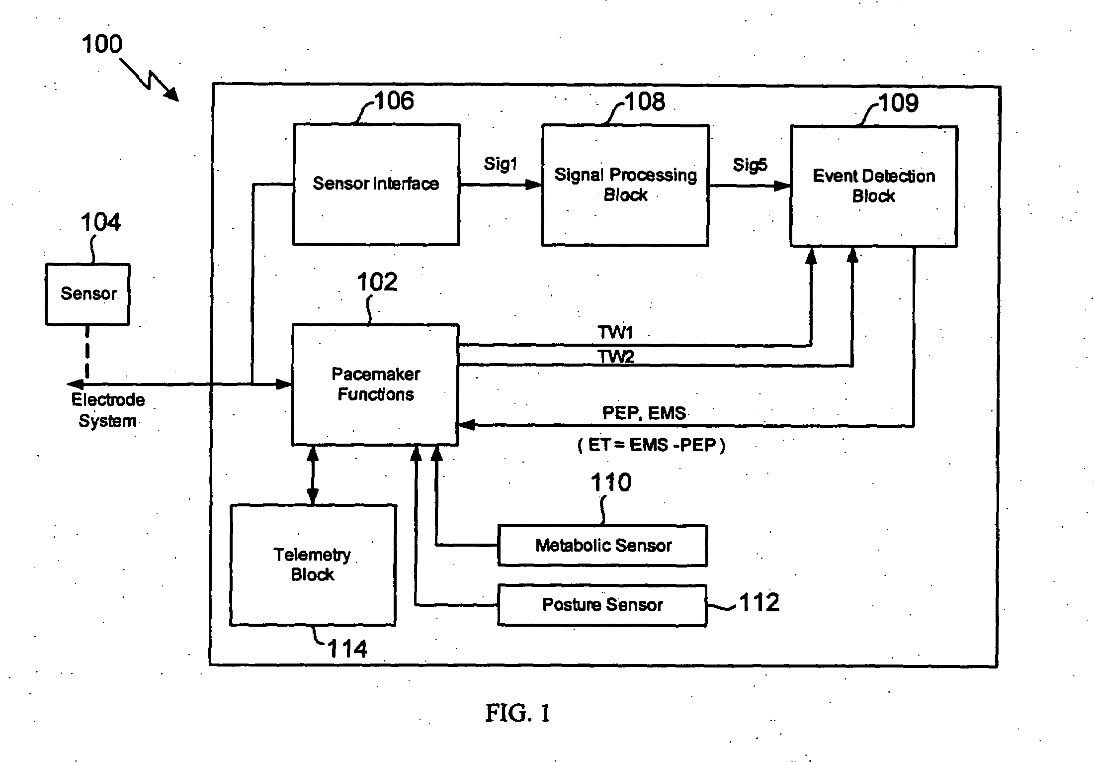 Method for extracting timing parameters using a cardio-mechanical sensor