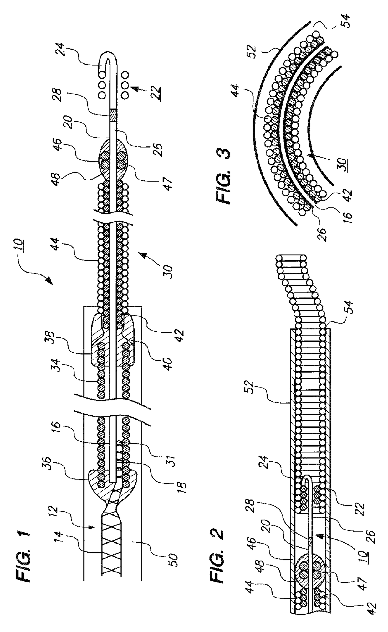 Vaso-occlusive delivery device with kink resistant, flexible distal end