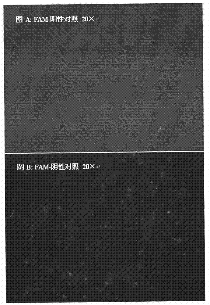 Human miR-133a antisense nucleic acid and application thereof