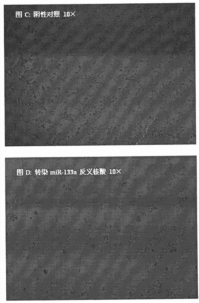 Human miR-133a antisense nucleic acid and application thereof