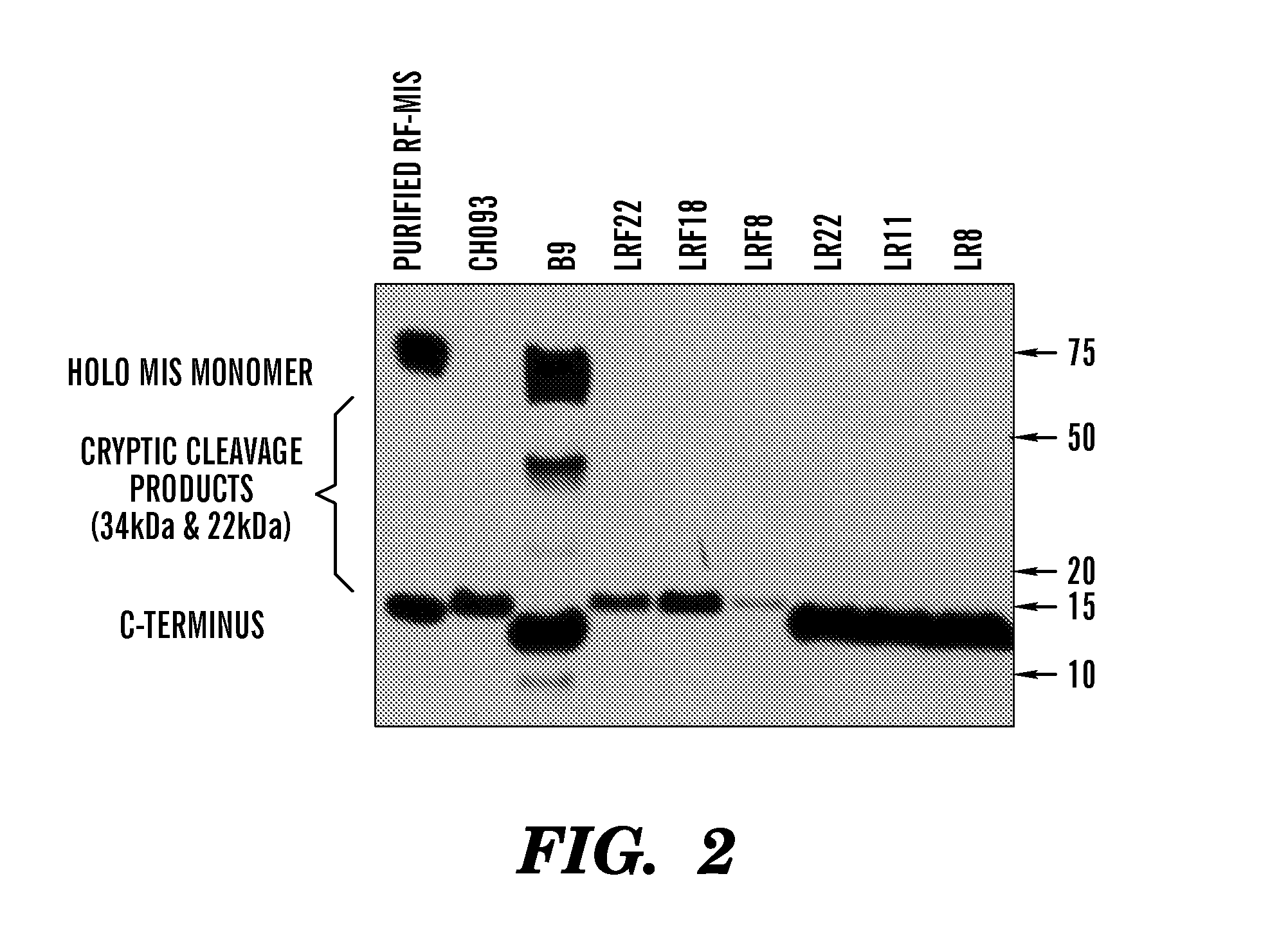 Modified mullerian inhibiting substance (MIS) proteins and uses thereof for the treatment of diseases