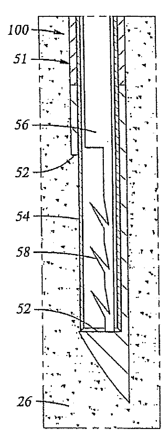Tools for Percutaneous Spinal Ligament Decompression and Device for Supporting Same