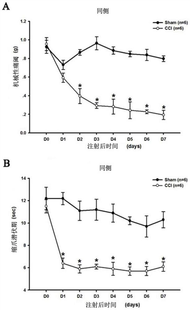 Application of antagonist of il-36r in preparation of analgesic medicine