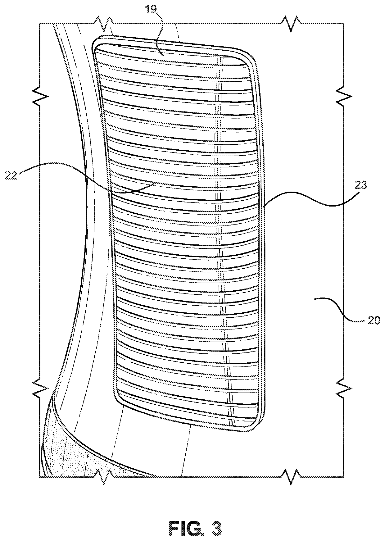 Orthopedic Collar