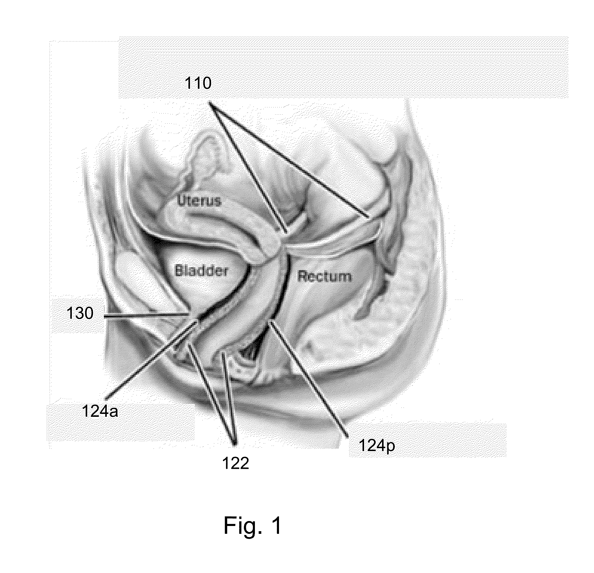Methods, compositions and kits for surgical repair