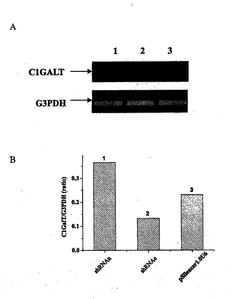 Use of ShRNA in preparing medicament for improving survival ratio of xenogenic organ transplantation