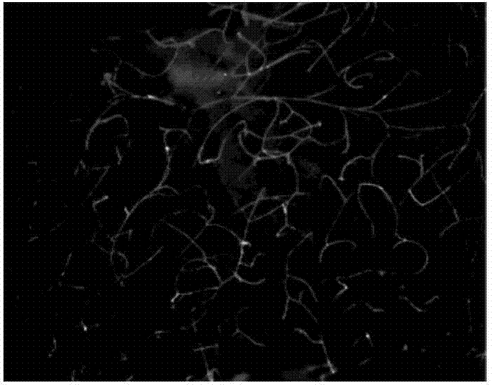 Double threshold blood vessel image processing method based on random direction histogram ratio