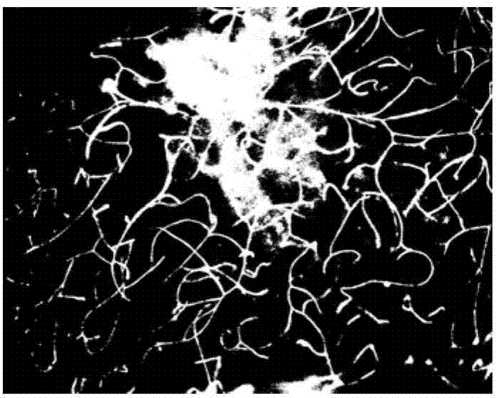 Double threshold blood vessel image processing method based on random direction histogram ratio