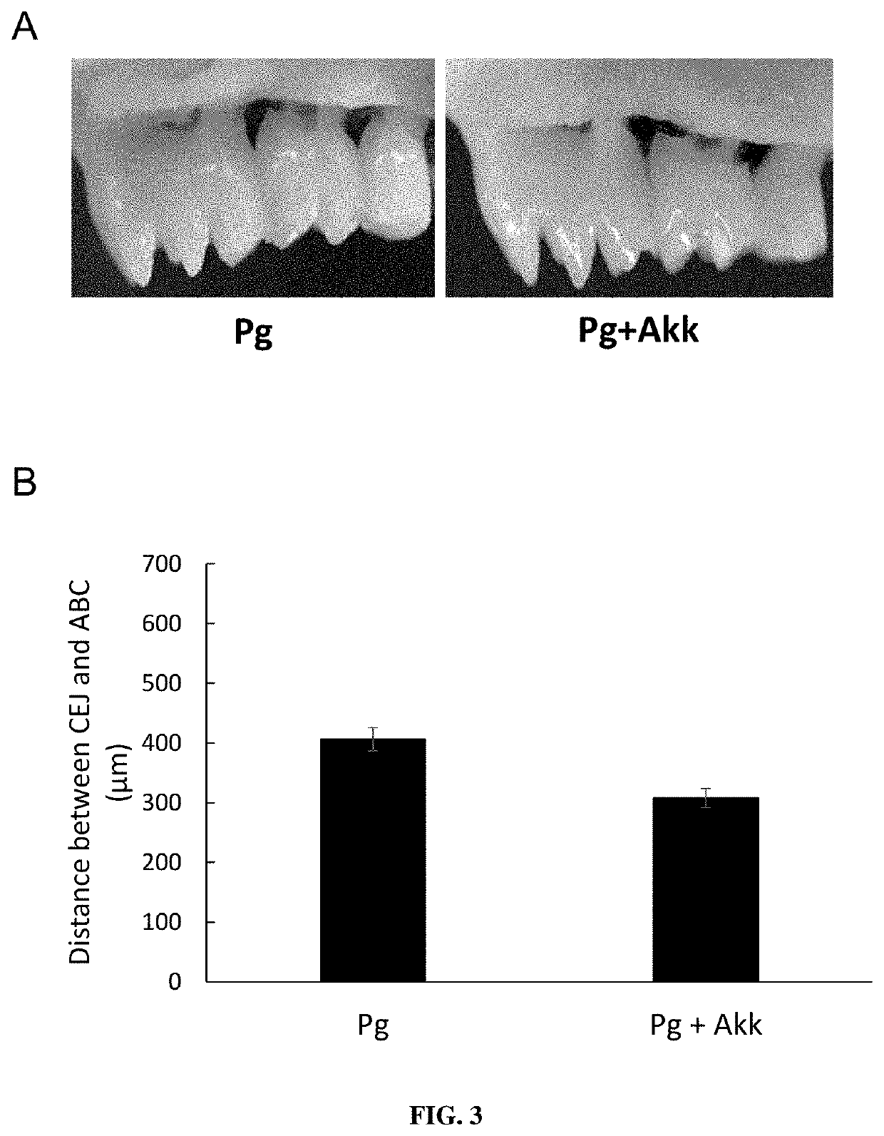 Use of akkermansia in the treatment of oral diseases
