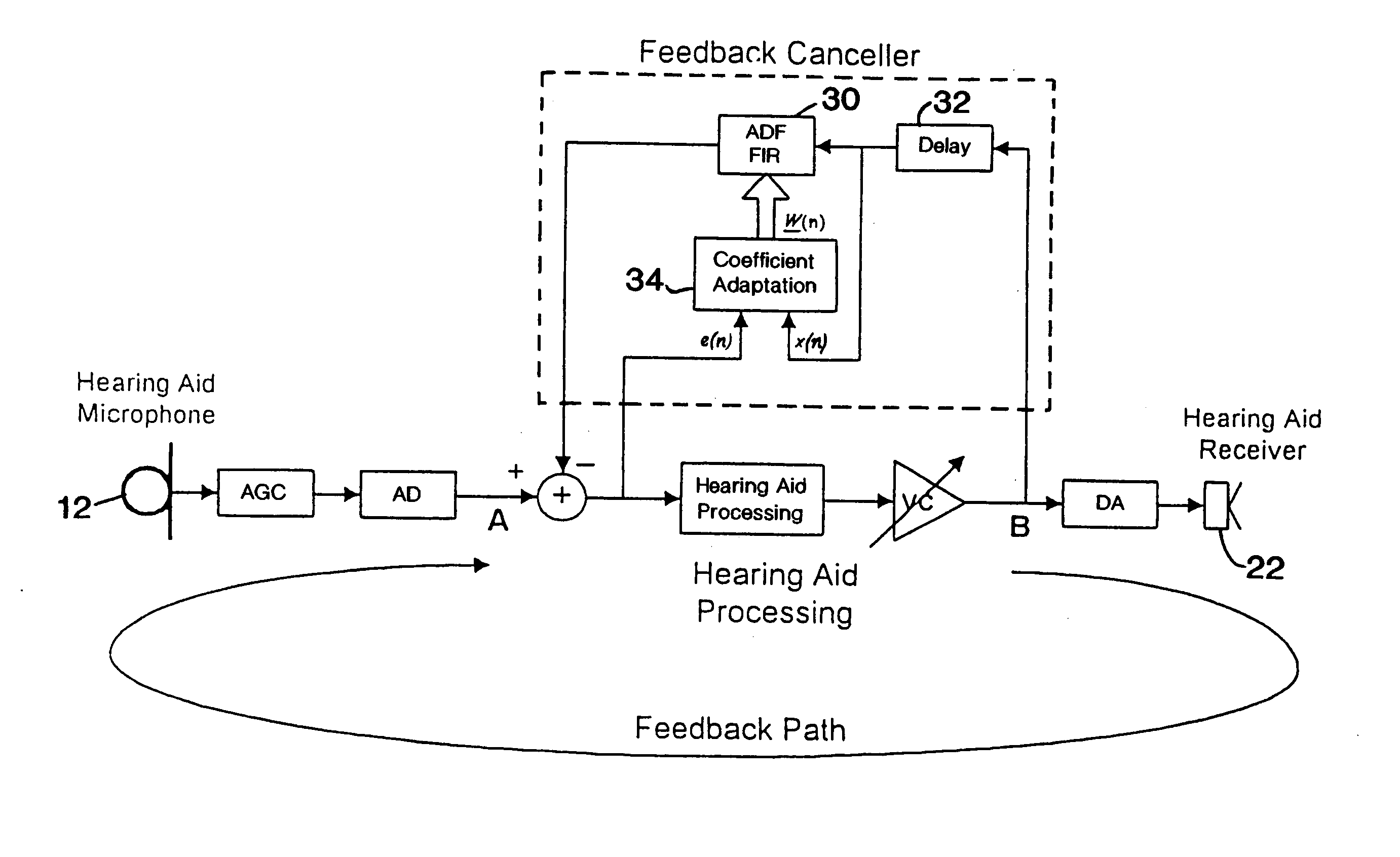 Band-limited adaptive feedback canceller for hearing aids