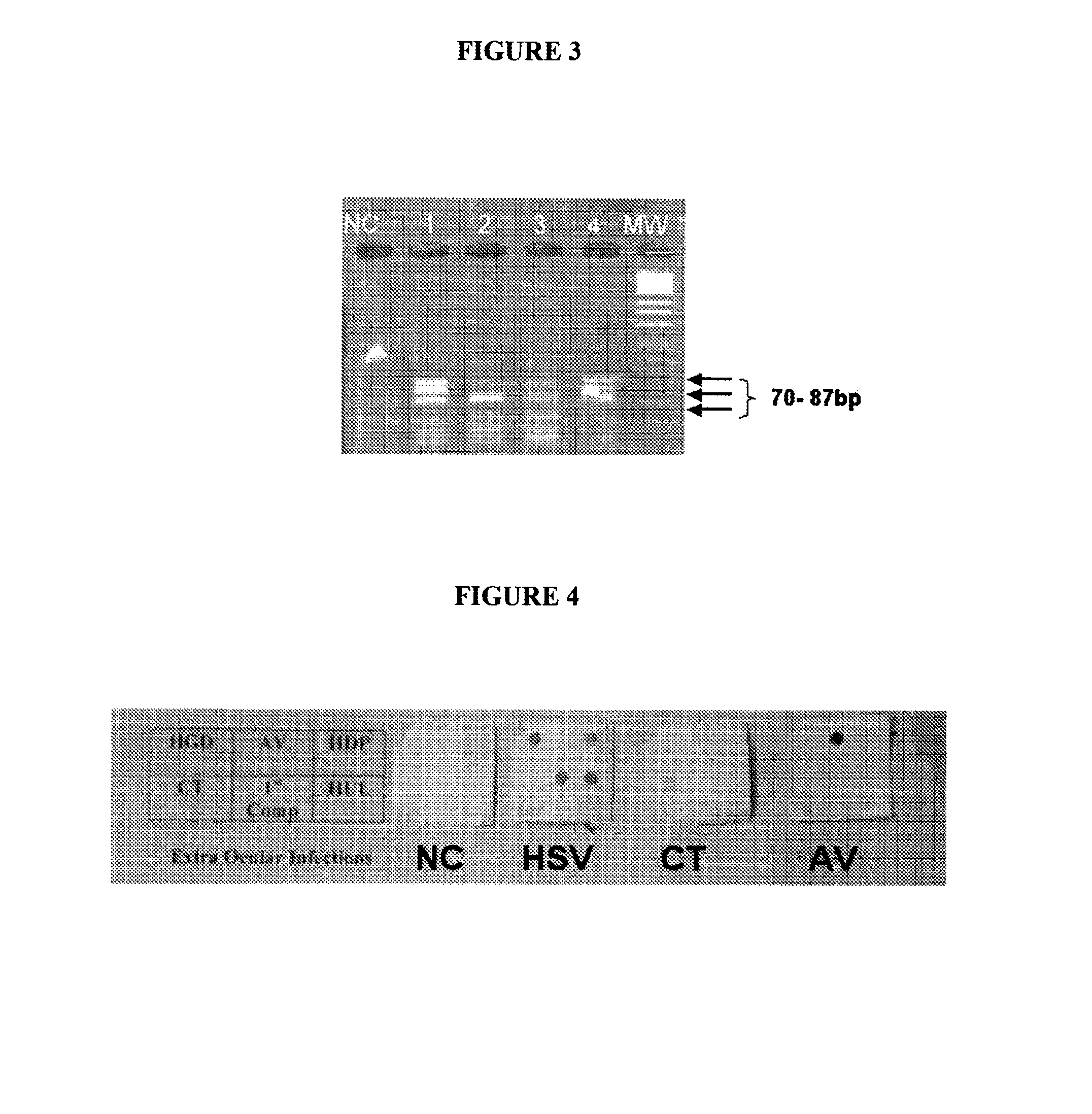 Method for simultaneous detection and discrimination of bacterial, fungal, parasitic and viral infections of eye and central nervous system