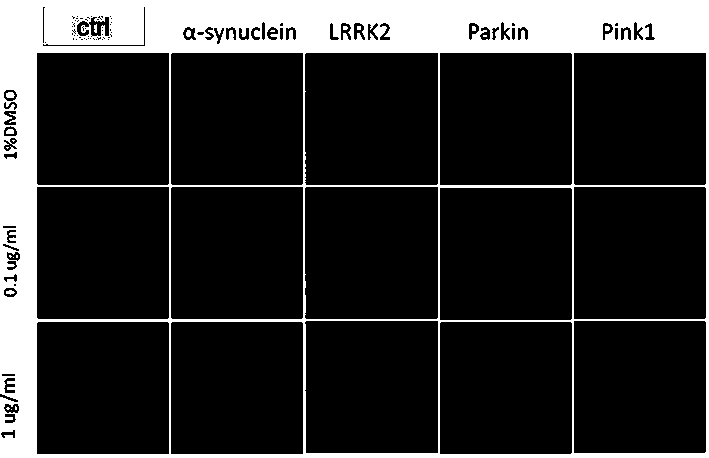 Application of u0126 in the preparation of drugs for the treatment of Parkinson's