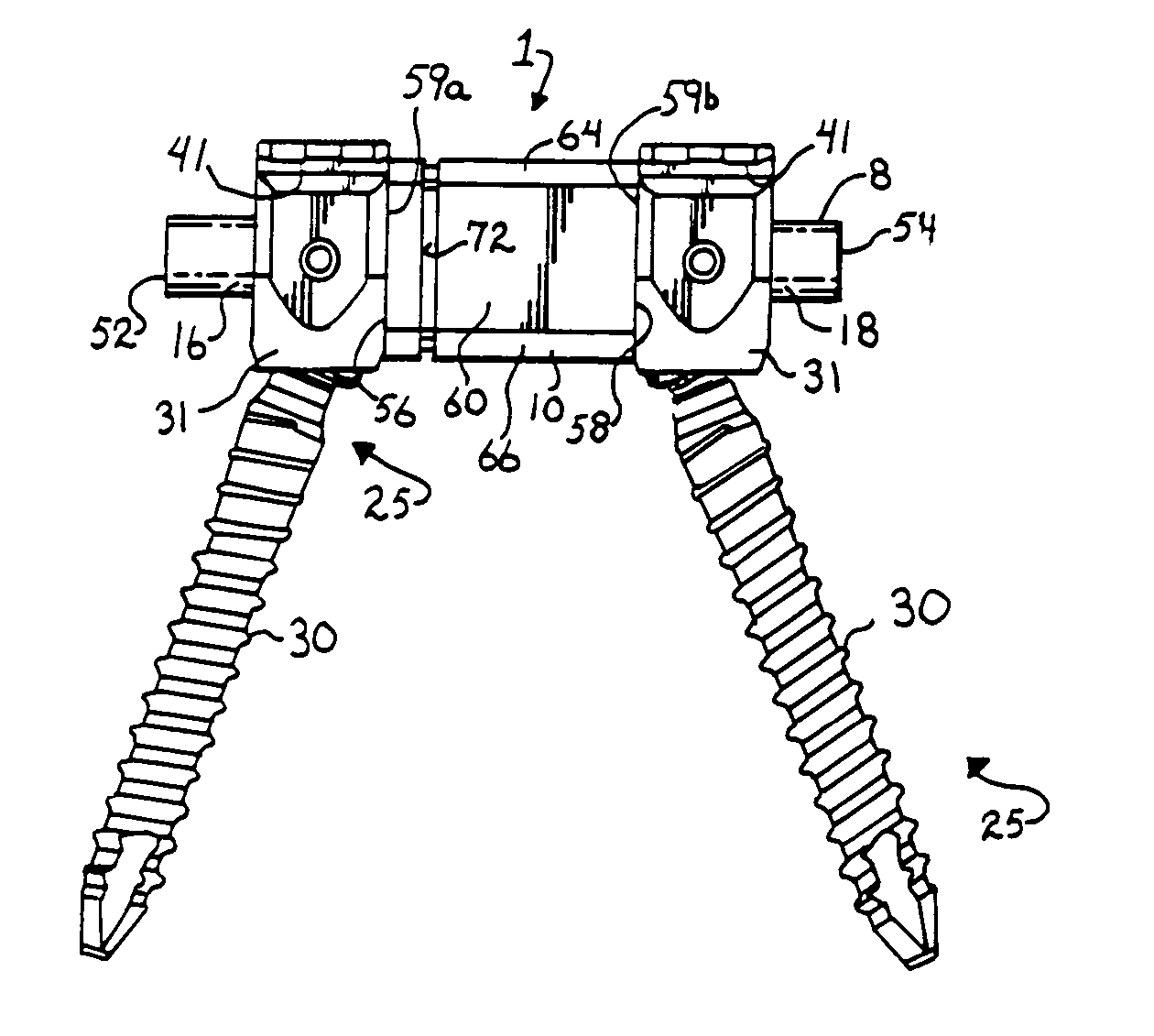 Dynamic stabilization connecting member with elastic core and outer sleeve