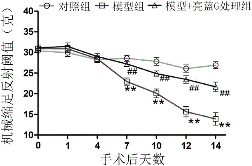 Application of brilliant blue G to preparation of drugs for human immunodeficiency virus glycoprotein 120 induced neuropathic pain