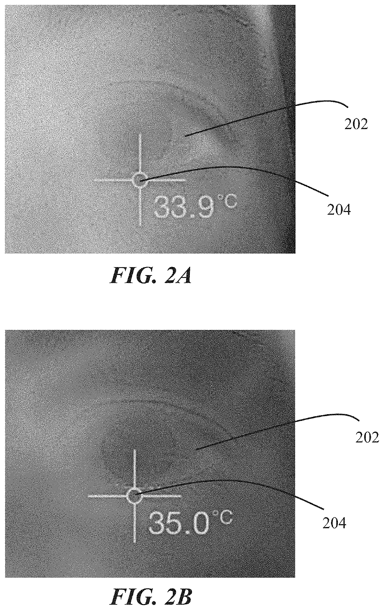 Intranasal stimulation for treatment of meibomian gland disease and blepharitis