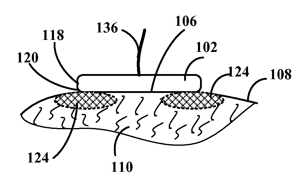 RF electrode for aesthetic and body shaping devices and method of using same