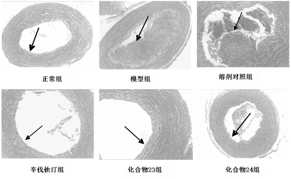 Beta-elemene 13-site derivative and use thereof in treatment of atherosclerosis