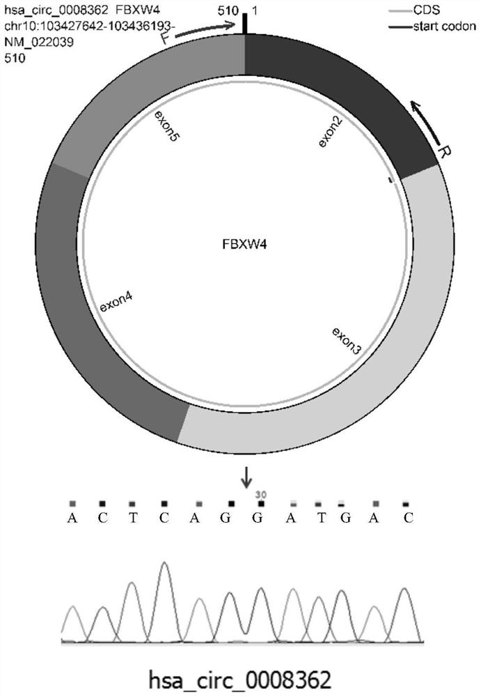 Abortion marker and application thereof in diagnosis and prediction of recurrent abortion pathology pregnancy