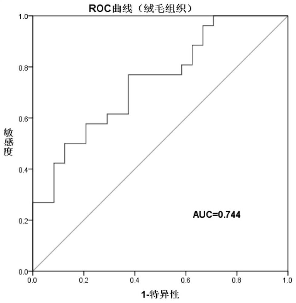 Abortion marker and application thereof in diagnosis and prediction of recurrent abortion pathology pregnancy