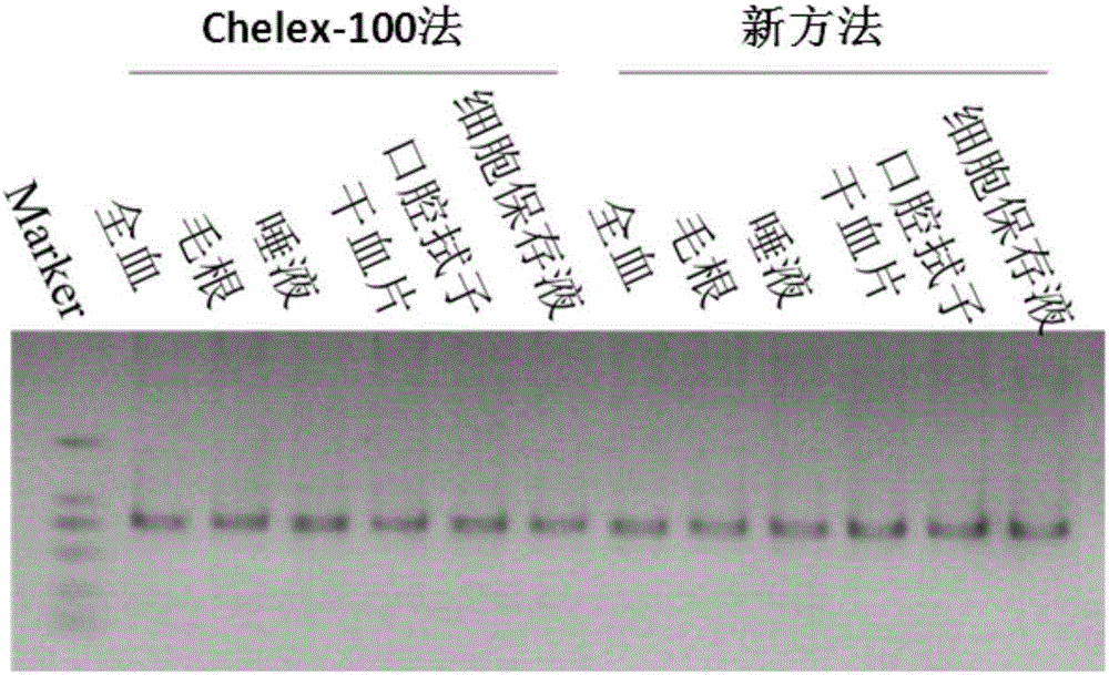 Eukaryotic cell nucleic acid extraction method