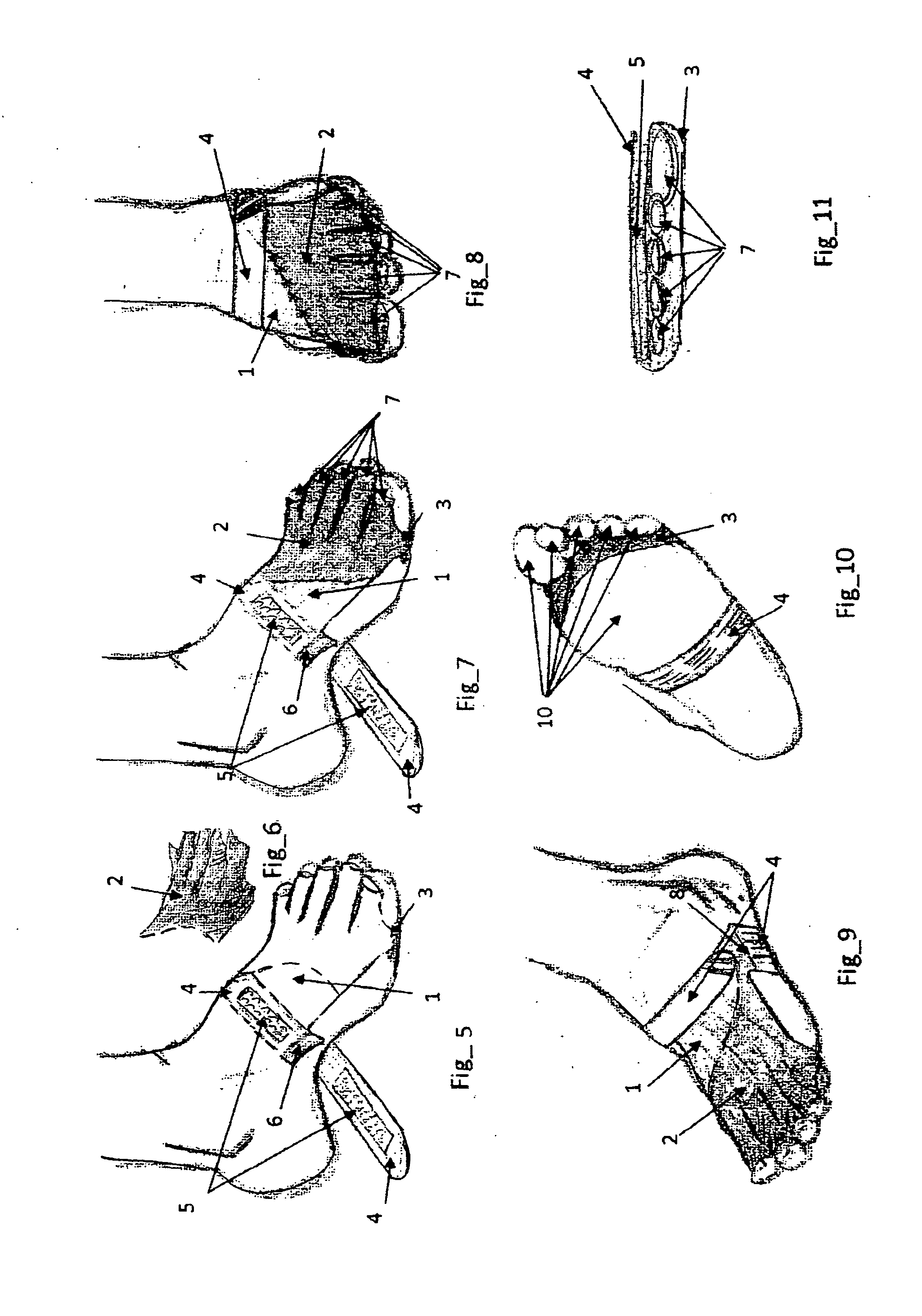 Toe Shield Glove (TSG)
