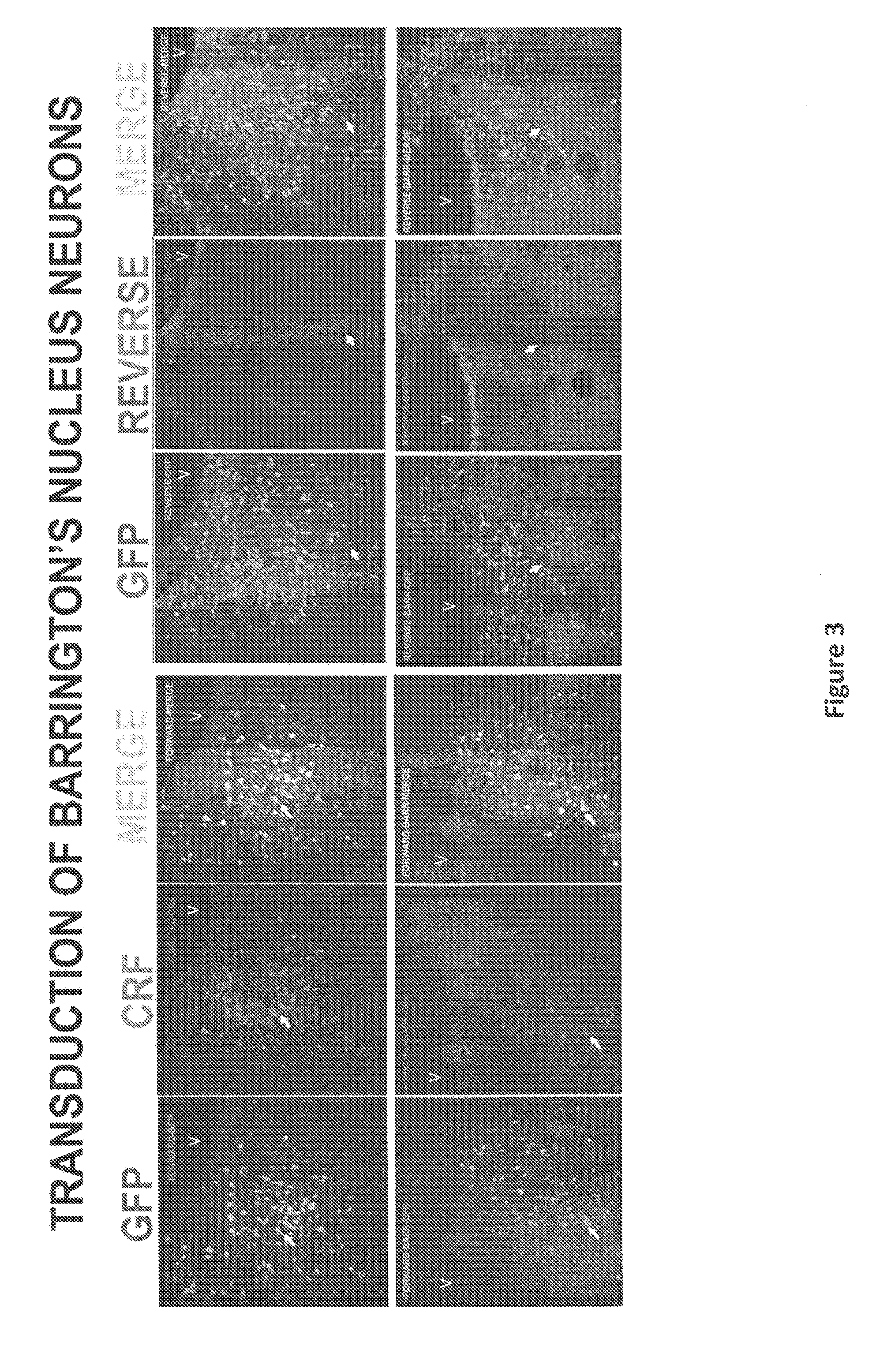 Compositions and Methods Useful for Treatment and Prevention of Incontinence