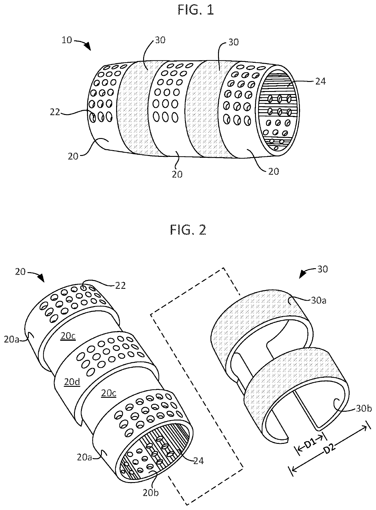 Splint