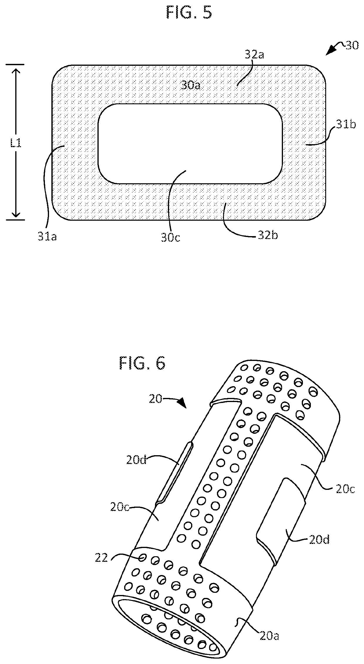 Splint