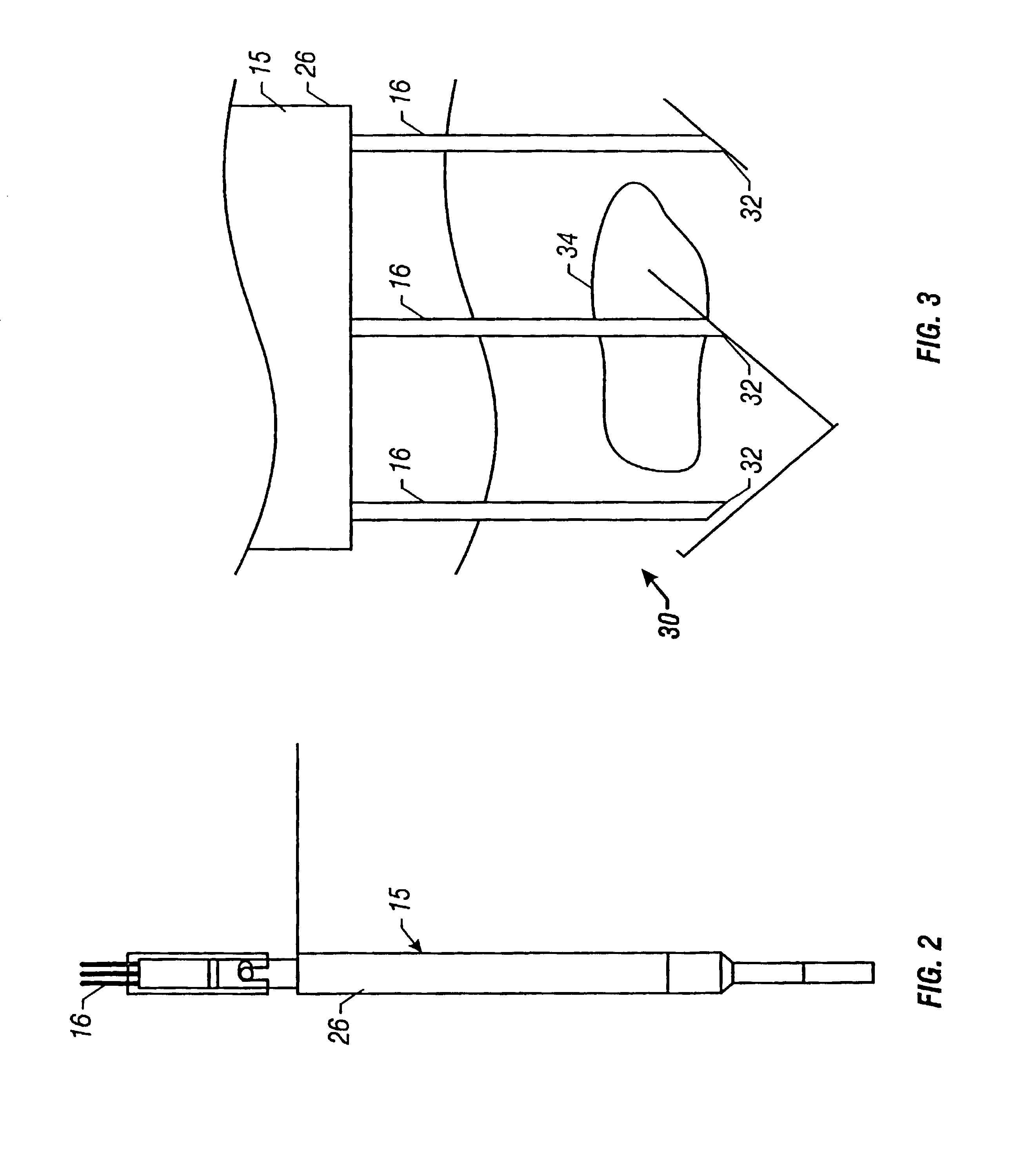 Method and apparatus for reducing electroporation-mediated muscle reaction and pain response