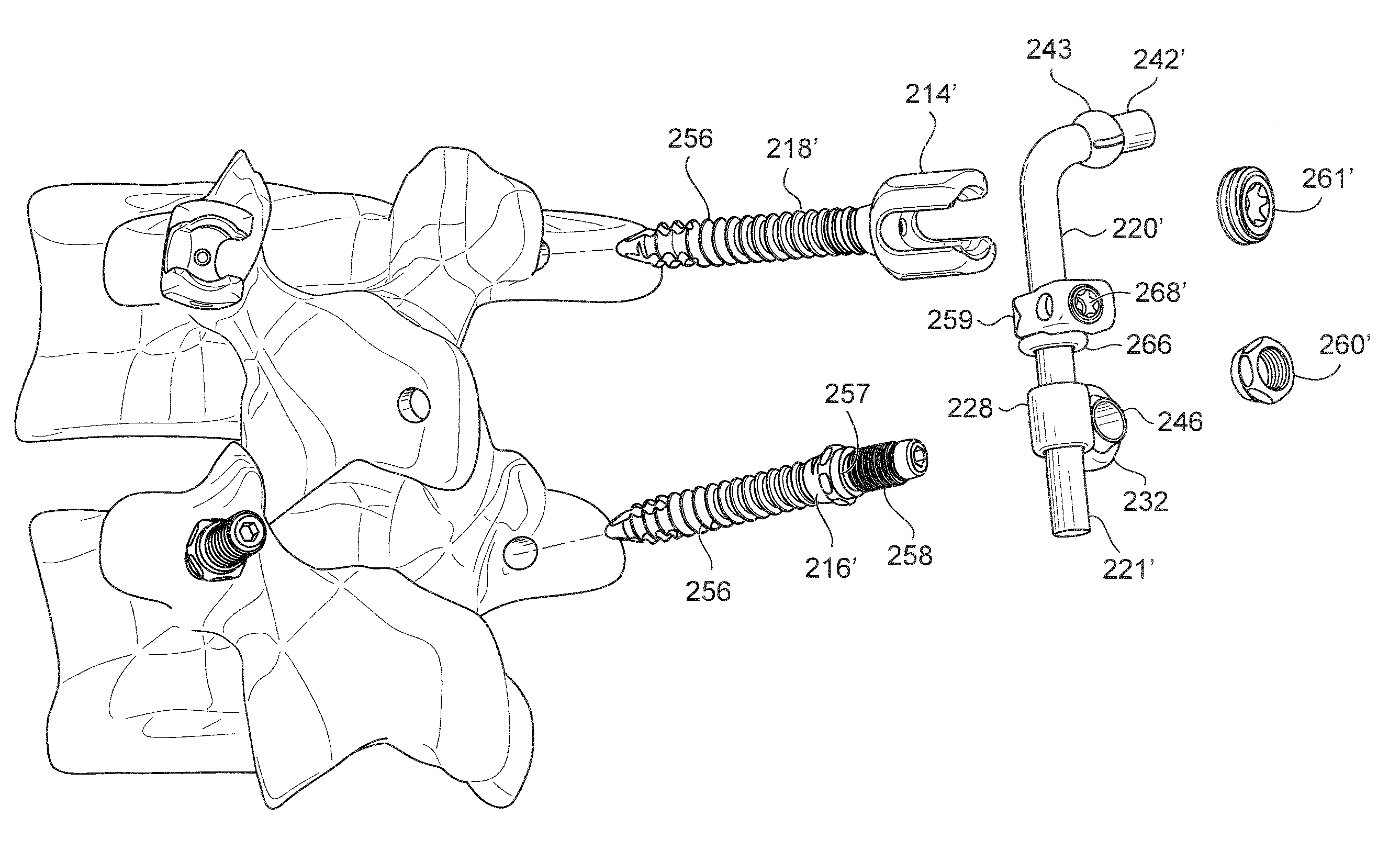 Posterior lumbar joint prosthesis