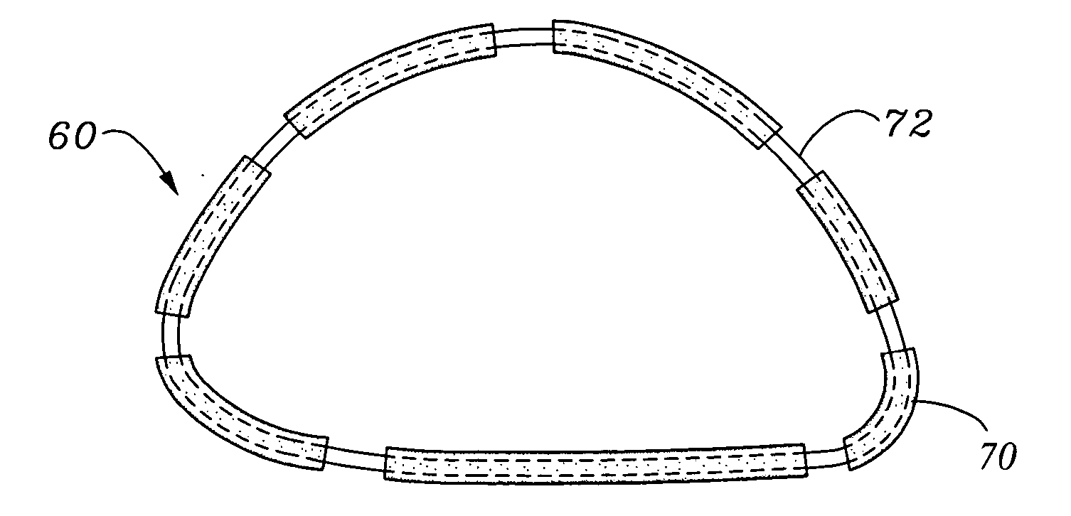 Self-molding annuloplasty ring